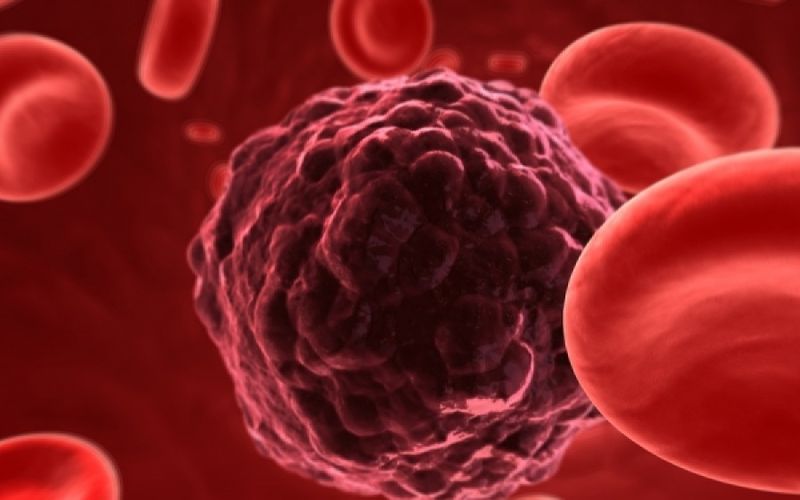 Πειραματικό τεστ αίματος ανιχνεύει οχτώ διαφορετικά είδη καρκίνου
