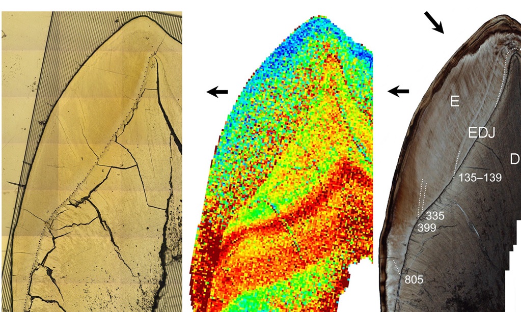 Ανακαλύφθηκε έκθεση σε μόλυβδο σε δόντια παιδιών Νεάντερταλ πριν 250.000 χρόνια