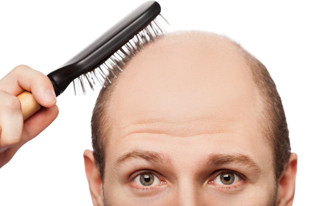 Ελπίδες για θεραπεία σε όσους χάνουν τα μαλλιά τους