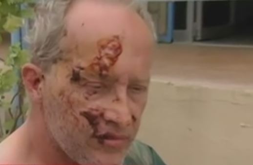 Ο σύζυγος της τραυματισμένης Αμερικανίδας περιγραφει όσα έζησε