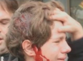 Ισπανία: Αντιδράσεις για τον τραυματισμό 13χρονου από αστυνομικούς