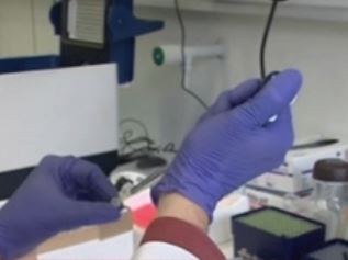 Ελληνες ερευνητές στη μάχη κατά του καρκίνου