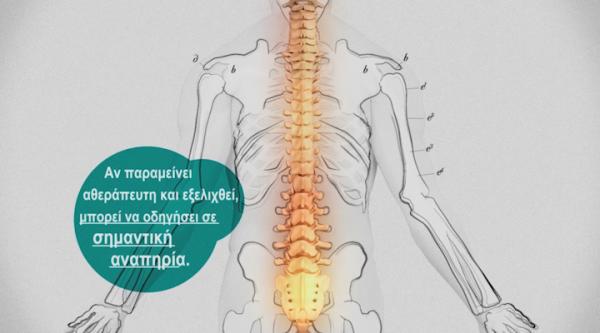 Αγκυλοποιητική Σπονδυλαρθρίτιδα