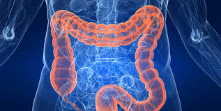 Νέα έρευνα ρίχνει φως στο γενετικό υπόβαθρό του καρκίνου του παχέος εντέρου