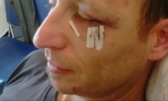 Χανιά: Νεαροί επιτέθηκαν σε γιατρό που υπερασπίστηκε μετανάστες