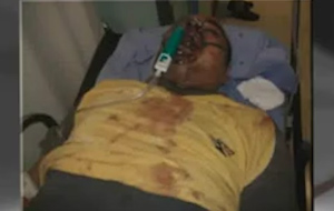 Ρατσιστική επίθεση ροπαλοφόρων στο Πέραμα