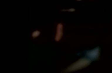 Μύκονος: Χαροπαλεύει 31χρονος που υπέστη ξυλοδαρμό από μπράβο σε μπαρ