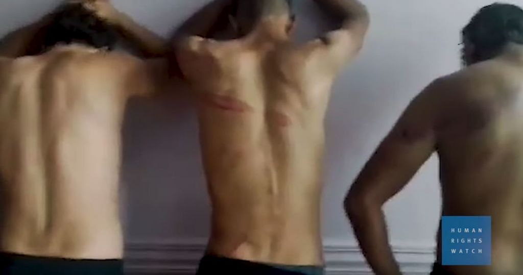 Στοιχεία – κόλαφος: Καταγγελίες για ξυλοδαρμούς προσφύγων στον Έβρο