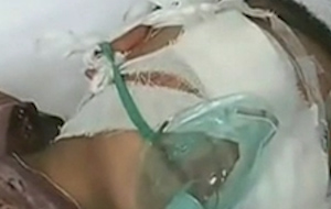 Κίνα: Νάρκωσαν 6χρονο και του αφαίρεσαν τα μάτια