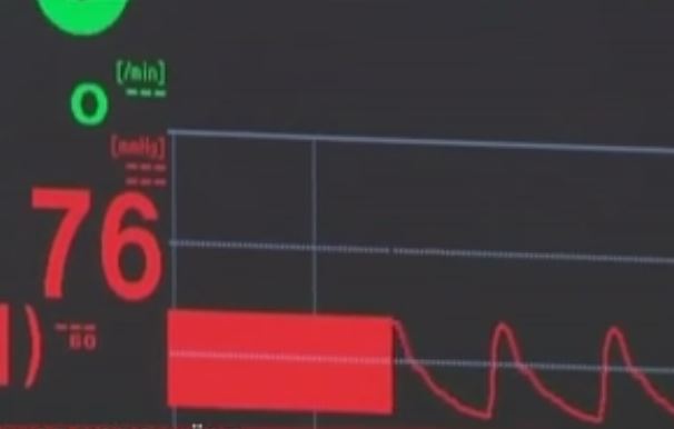 Σε επαγρύπνηση το ΚΕΕΛΠΝΟ για το κρούσμα του κοροναϊού MERS