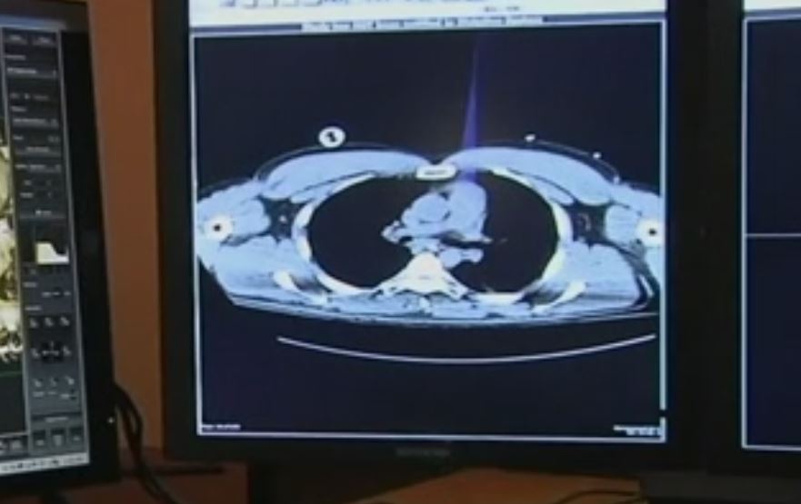 Πλαφόν σε κλινικές και διαγνωστικές εξετάσεις από το υπουργείο Υγειας