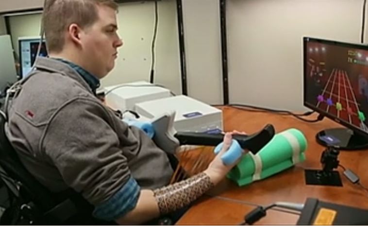 Τσιπ στον εγκέφαλο επαναφέρει την κινητικότητα τετραπληγικού