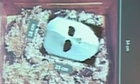 Τα οστά του Φιλίππου του Β’ στον βασιλικό τάφο ΙΙ των Αιγών