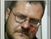 Επίθεση σε Έλληνα δημοσιογράφο στην Κριμαία