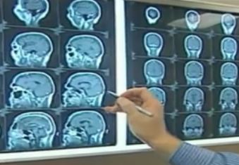 «Μαχαίρι» στις διαγνωστικές εξετάσεις των ασφαλισμένων του ΕΟΠΥΥ