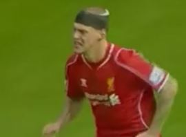 Με πρωταγωνιστή τον Σκρτελ το 2-2 στο Άρσεναλ-Λίβερπουλ