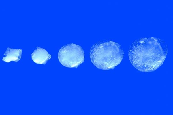 «Έξυπνο» χάπι κατασκοπεύει την υγεία μας και προλαβαίνει παθήσεις