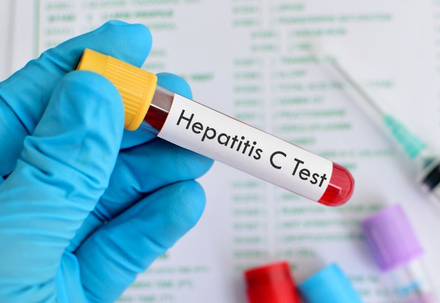 Ηπατίτιδα C : Ειδοποίηση για εξέταση σε όσους γεννήθηκαν μεταξύ 1945 -1980