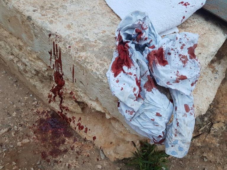 Διεύρυνση της βάσης του ρατσισμού στις γειτονιές «βλέπουν» ανθρωπιστικές οργανώσεις