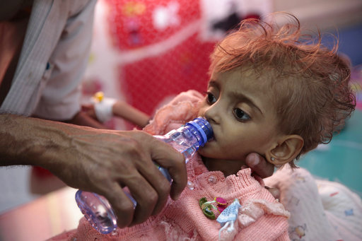 Τραγωδία δίχως τέλος στην Υεμένη: 8 παιδιά σκοτώνονται ή τραυματίζονται καθημερινά