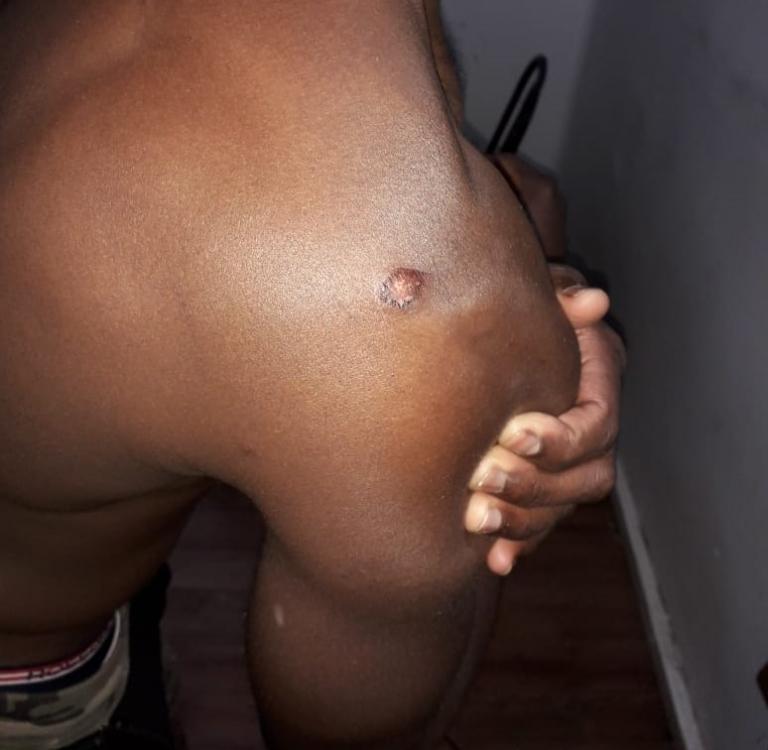 «Μαύρε πήγαινε στη χώρα σου»: Καταγγελία για ξυλοδαρμό πρόσφυγα από αστυνομικούς