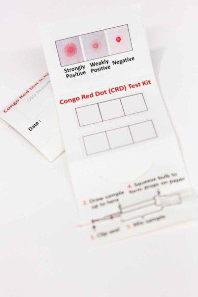 Τεστ ούρων ανιχνεύει την προεκλαμψία σε τρία λεπτά