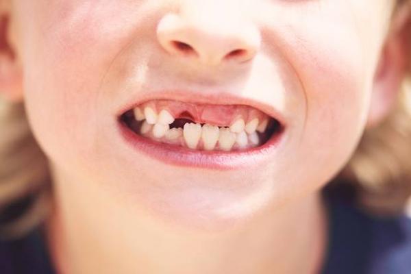 Γιατί οι γονείς δεν πρέπει να πετάνε τα παιδικά δόντια