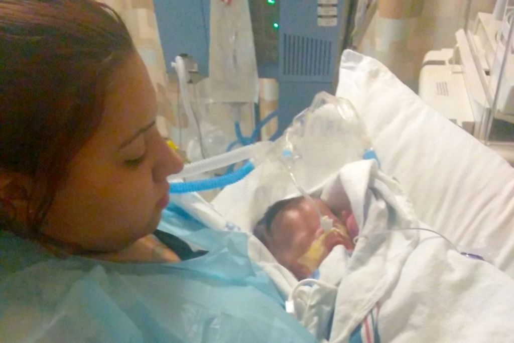 Τέξας: Τη δική του μάχη για τη ζωή δίνει το μωρό που γεννήθηκε χωρίς δέρμα