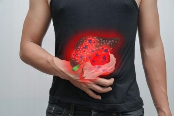 «Καμπανάκι» από την αύξηση των κρουσμάτων καρκίνου του εντέρου σε νέους