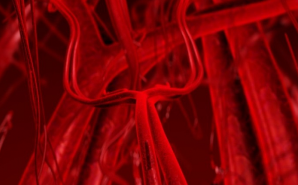 Ανεύρυσμα κοιλιακής εορτής: Εννέα στις δέκα φορές θανατηφόρο