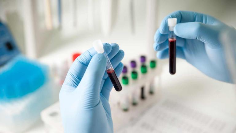 Συνεχίζεται η ταλαιπωρία των ασφαλισμένων στα διαγνωστικά κέντρα