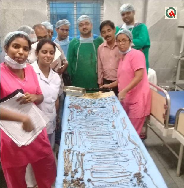 Απίστευτο: Γυναίκα είχε καταπιεί κοσμήματα αξίας 60.000 ευρώ