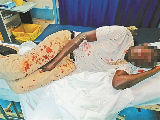 Η ρατσιστική βία γίνεται… συνήθεια