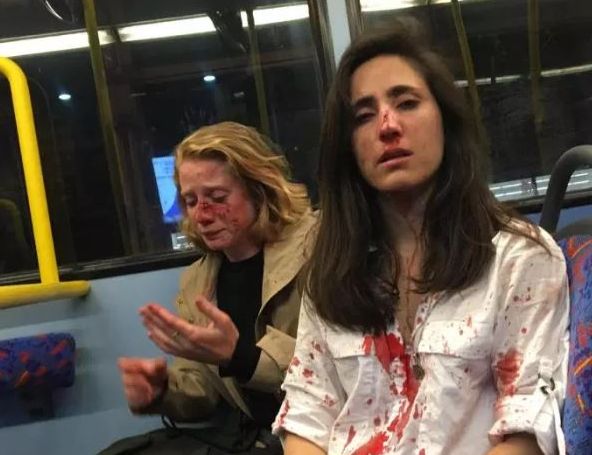 Λονδίνο: «Εγκλημα μίσους» η επίθεση στο ζευγάρι γυναικών