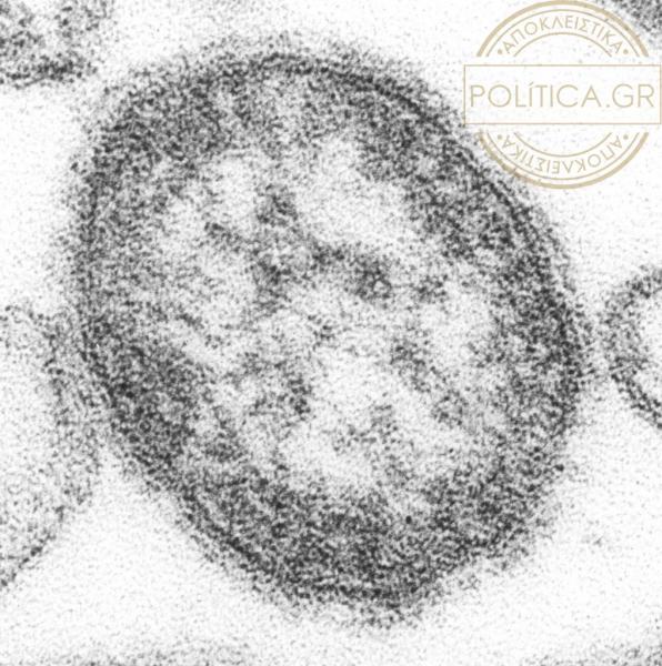 Οχυρωμένη η Κρήτη κατά της ιλαράς – Μεγάλα τα ποσοστά του ιού