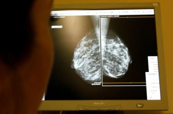 Οι θεραπείες της εμμηνόπαυσης αυξάνουν τον κίνδυνο εμφάνισης καρκίνου του μαστού