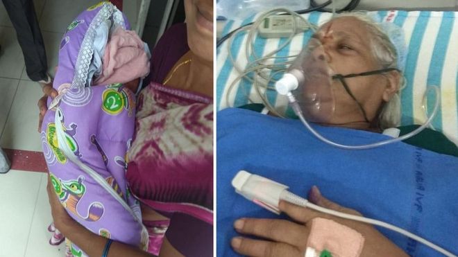 Ινδία: 73χρονη γέννησε δίδυμα και την επομένη ο 82χρονος σύζυγός της υπέστη εγκεφαλικό