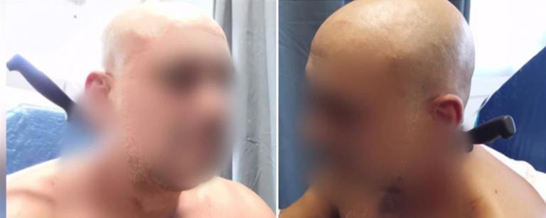 Απίστευτο: Τον κάρφωσε  η κουμπάρα του με μαχαίρι στο λαιμό