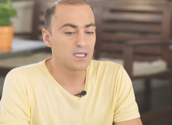 Θανάσης Αλευράς : Αποκάλυψε ότι πάσχει από ψωρίαση