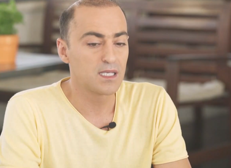 Θανάσης Αλευράς : Αποκάλυψε ότι πάσχει από ψωρίαση