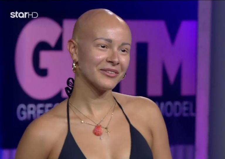 GNTM: Η συγκινητική ιστορία της παίκτριας με αλωπεκία