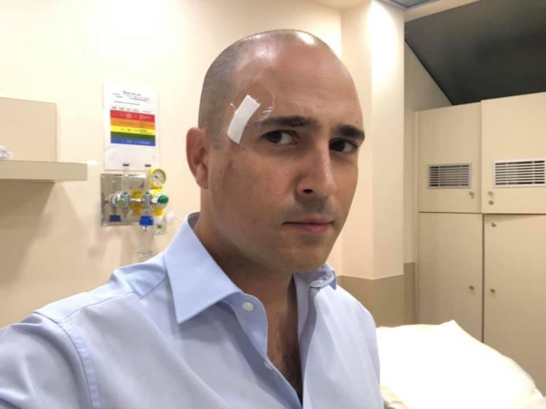 Στο νοσοκομείο ο Μπογδάνος μετά από ατύχημα στη βροχή