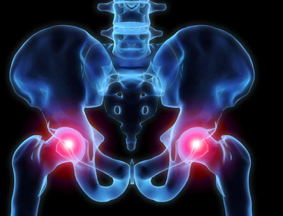 Κάταγμα ισχίου : Η ημιαρθροπλαστική μπορεί να έχει το ίδιο καλά αποτελέσματα με την ολική αρθροπλαστική | in.gr