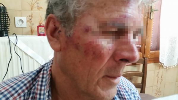 Σάμος: 73χρονος δέχθηκε επίθεση από Τούρκους επειδή…άκουγε λειτουργία