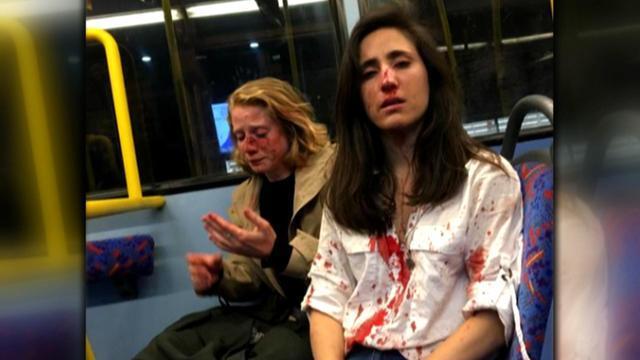 Λονδίνο : Σοκάρει το βίντεο επίθεσης νεαρών σε ζευγάρι γυναικών που αρνήθηκε να φιληθεί