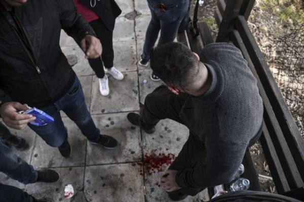 Καβούρι : Τέσσερις τραυματίες από τις συμπλοκές ΜΑΤ και φοιτητών