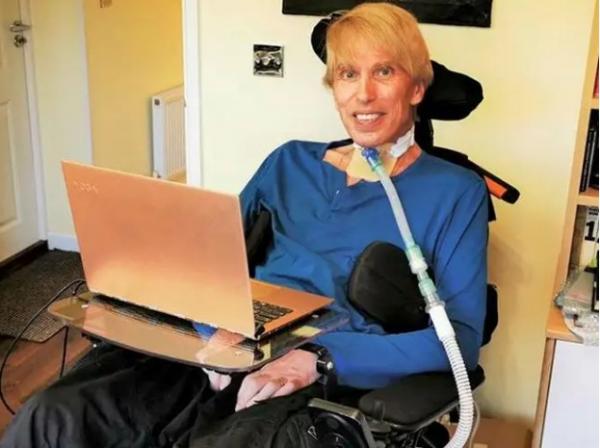 Ετοιμοθάνατος επιστήμονας γίνεται το πρώτο cyborg – «Δεν πεθαίνω, μεταμορφώνομαι»