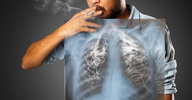 Τσιγάρο : Οι συνέπειες του καπνίσματος στην υγεία