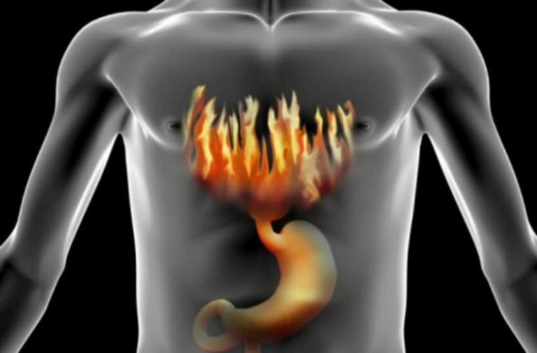 Οι τροφές που καταπραϋνουν από τις καούρες