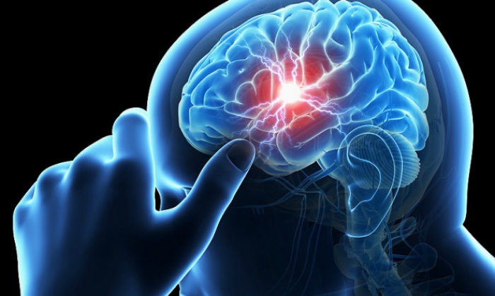 Εγκεφαλικό : Τα συμπτώματα και πώς να τα αναγνωρίσετε